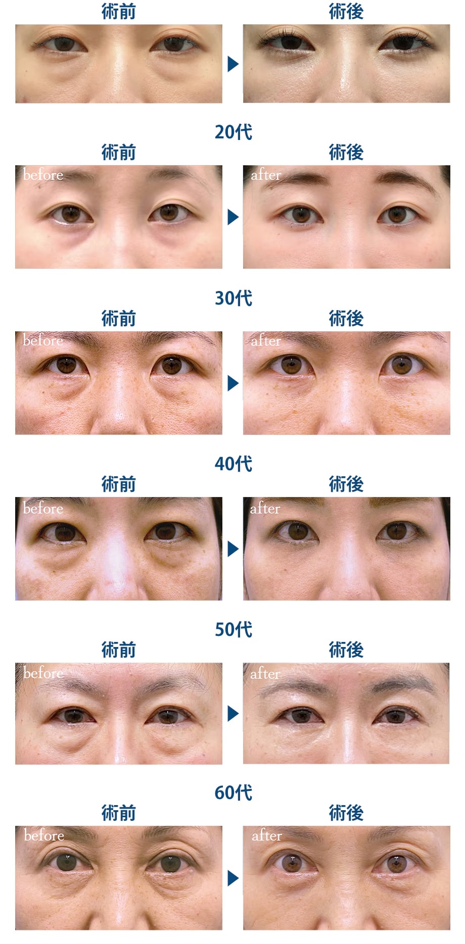 料金下症例写真