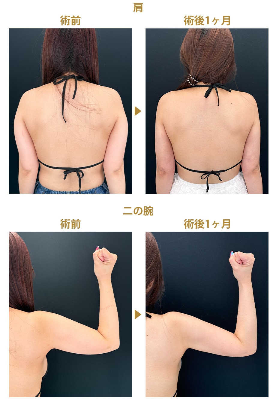 ピックアップ症例写真