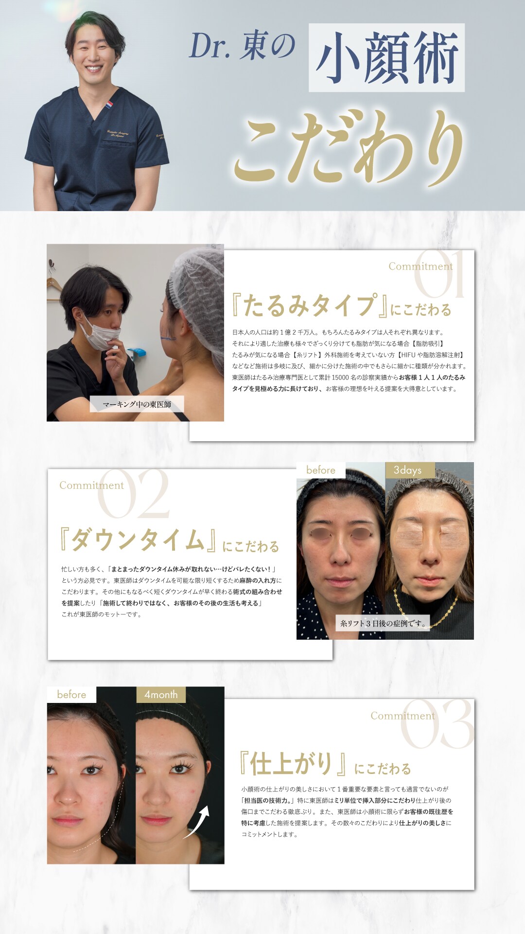 小顔術こだわり