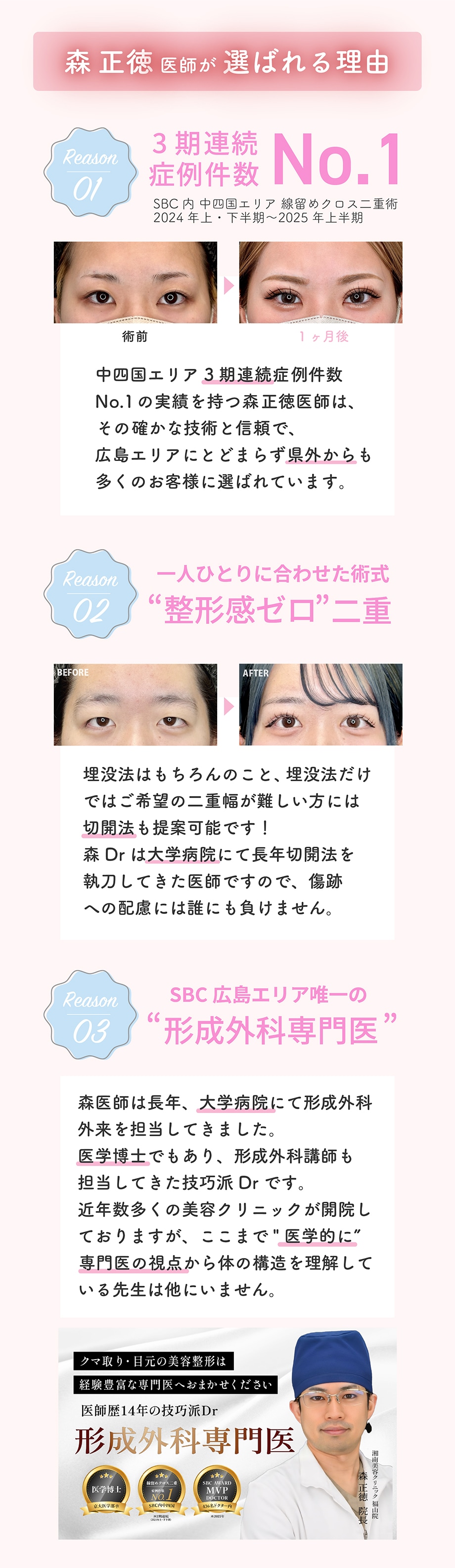 選ばれる理由