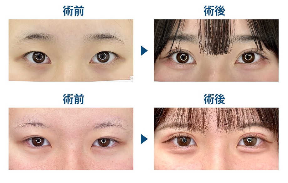 ピックアップ症例写真