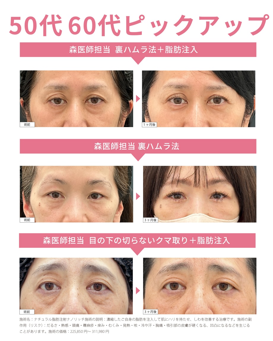 料金下症例写真