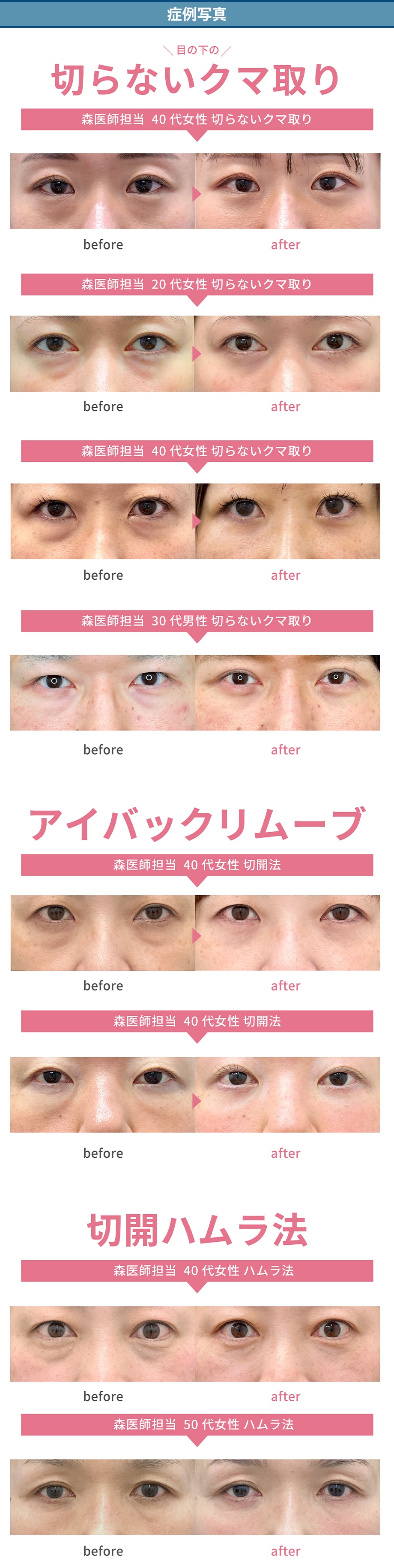 料金下症例写真