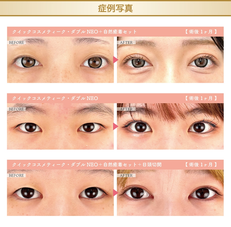 料金下症例写真