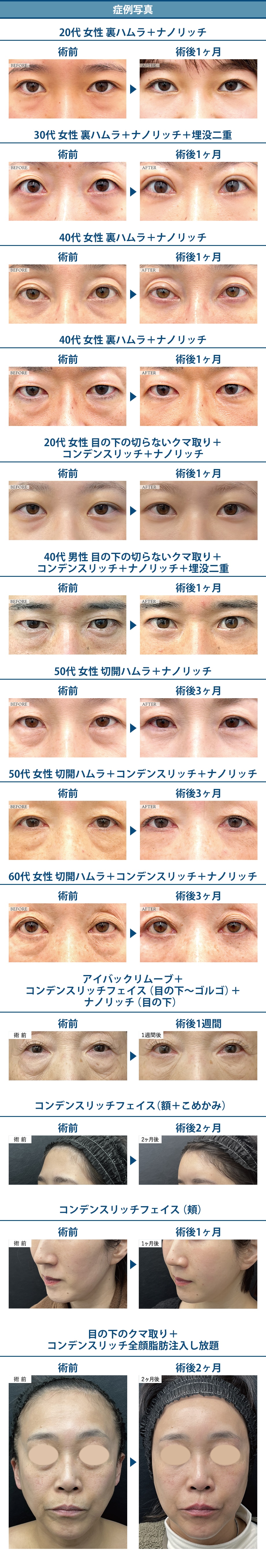 料金下症例写真