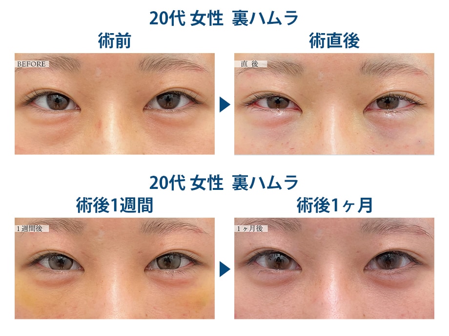 ピックアップ症例