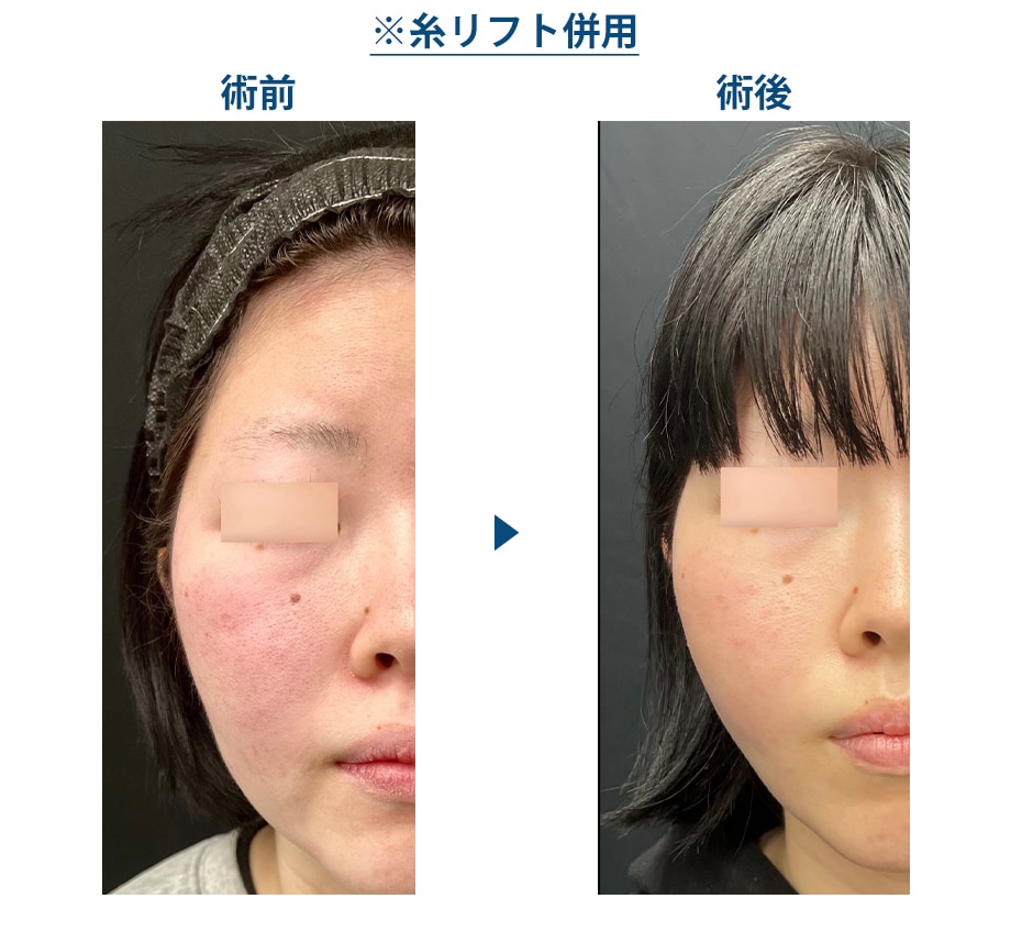 ピックアップ症例写真