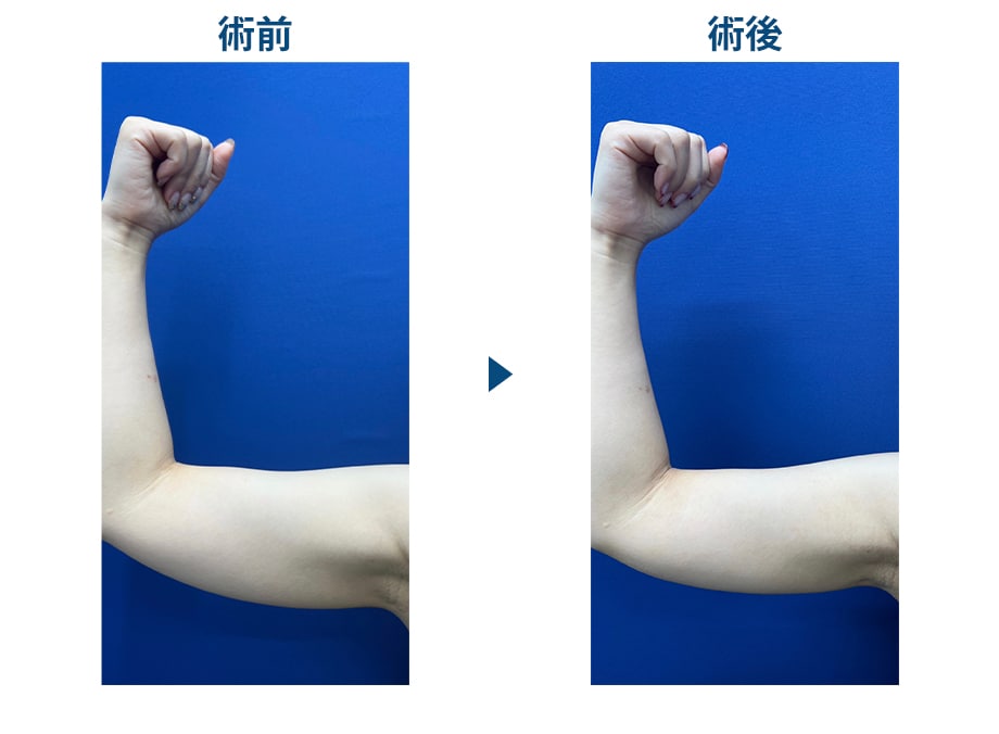 ピックアップ症例写真