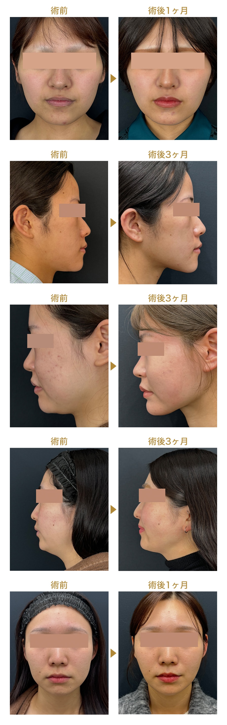 ピックアップ症例写真