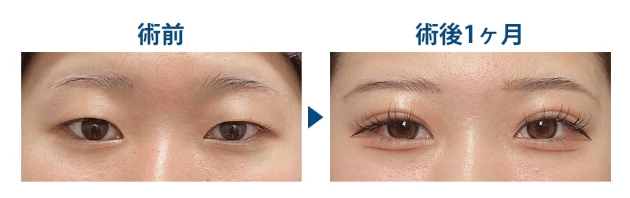 ピックアップ症例写真