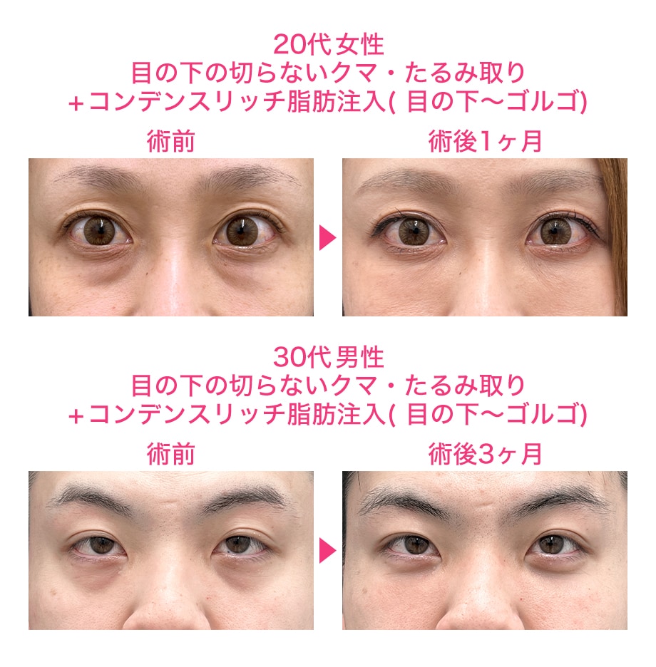 ピックアップ症例写真