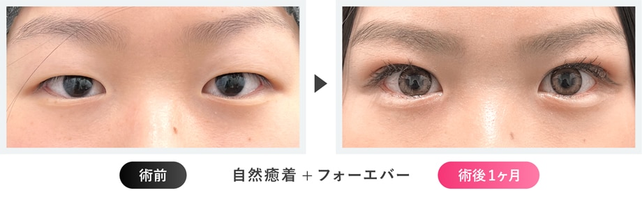 症例写真
