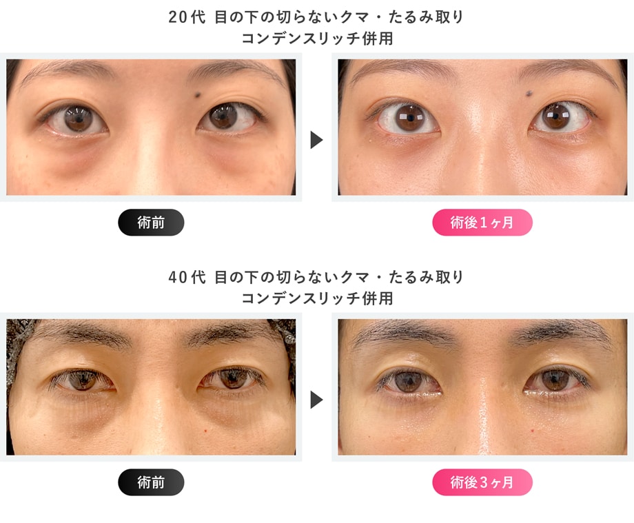 症例写真
