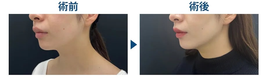 ピックアップ症例写真