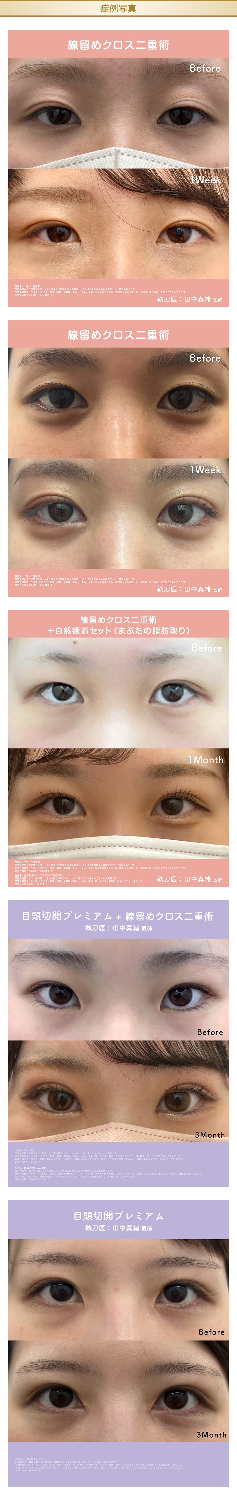 料金下症例写真