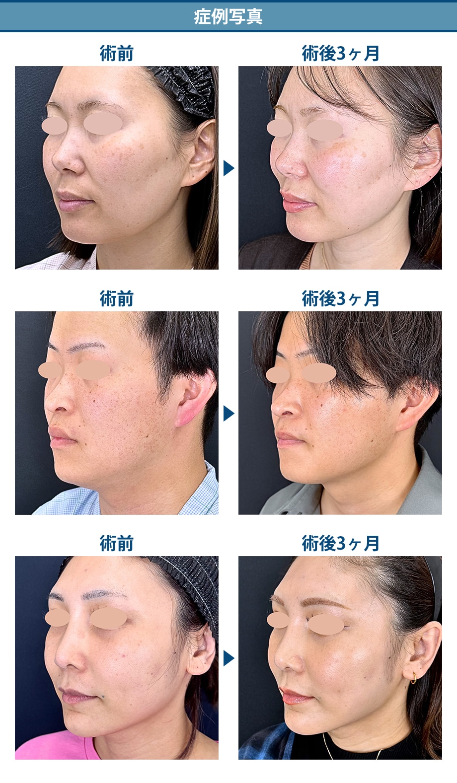 料金下症例写真