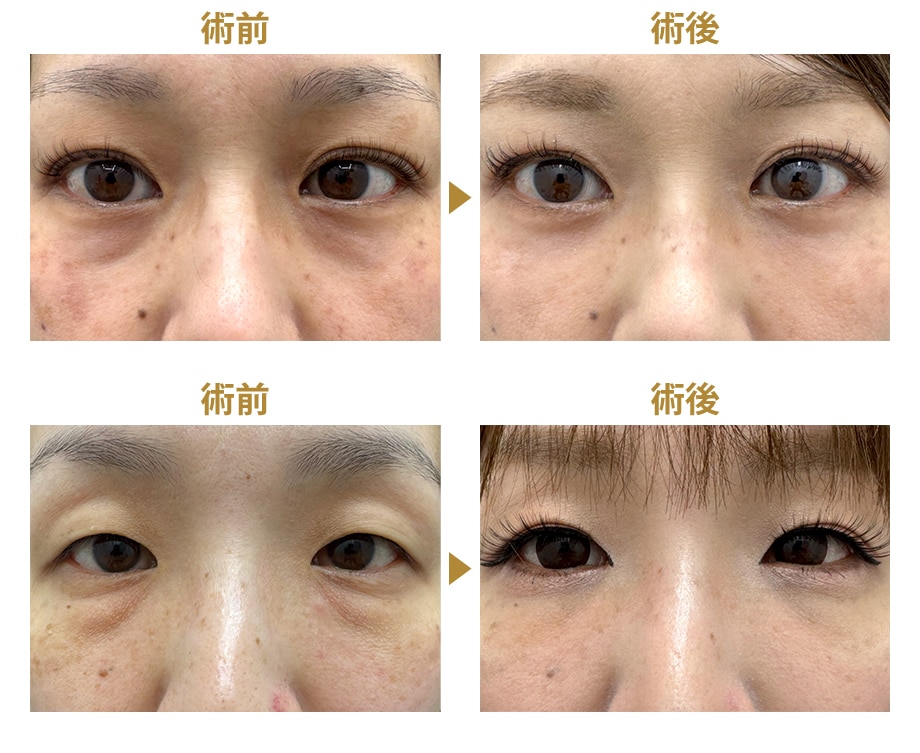 ピックアップ症例写真