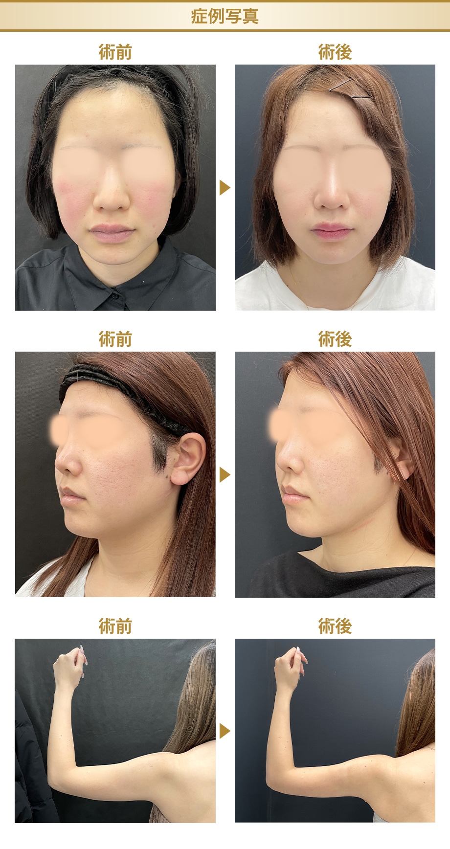 ピックアップ症例写真