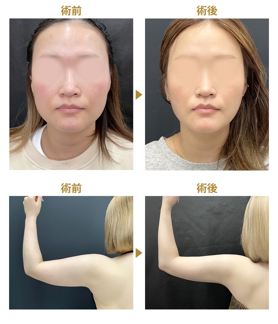 ピックアップ症例写真