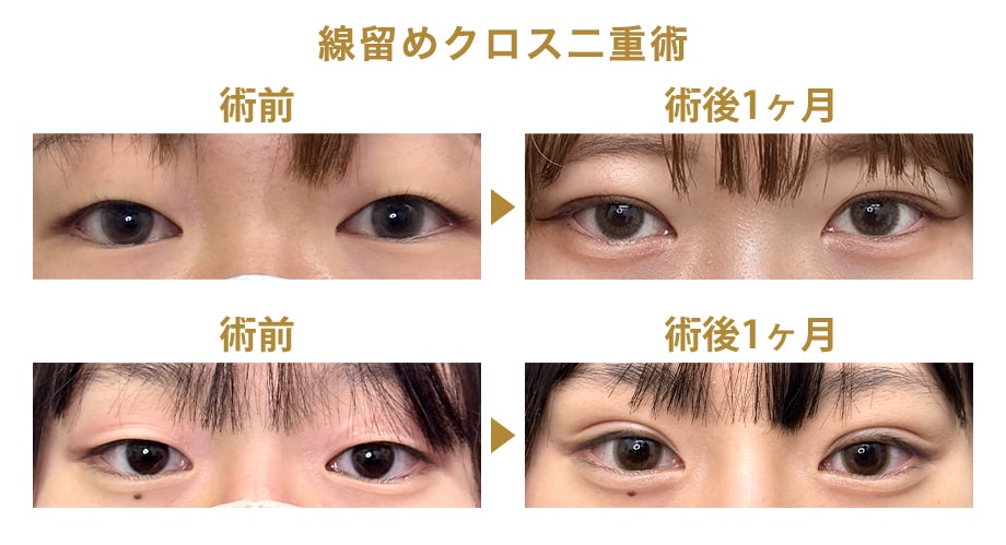 ピックアップ症例写真