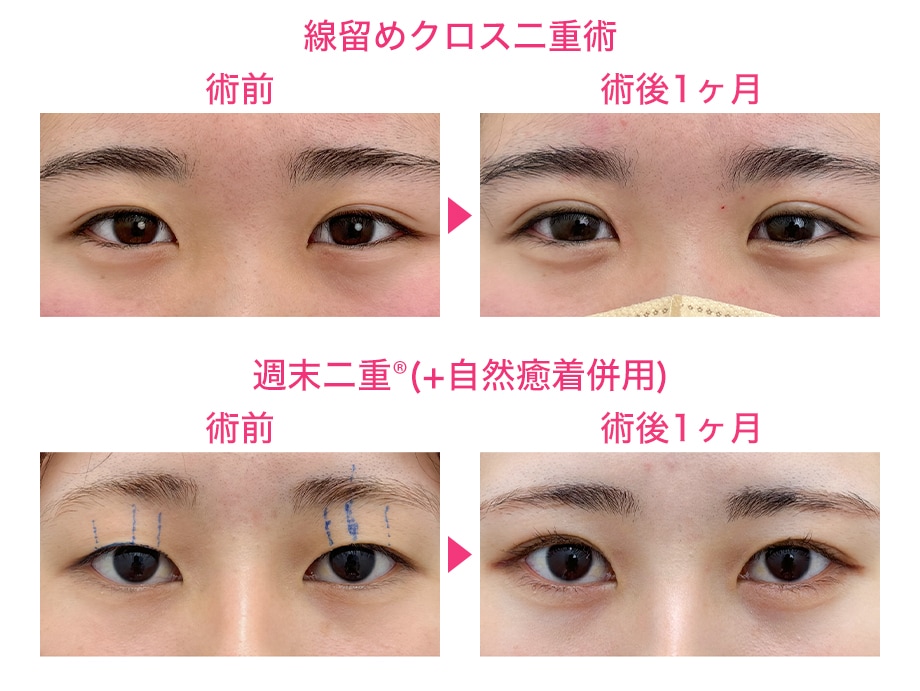 ピックアップ症例写真