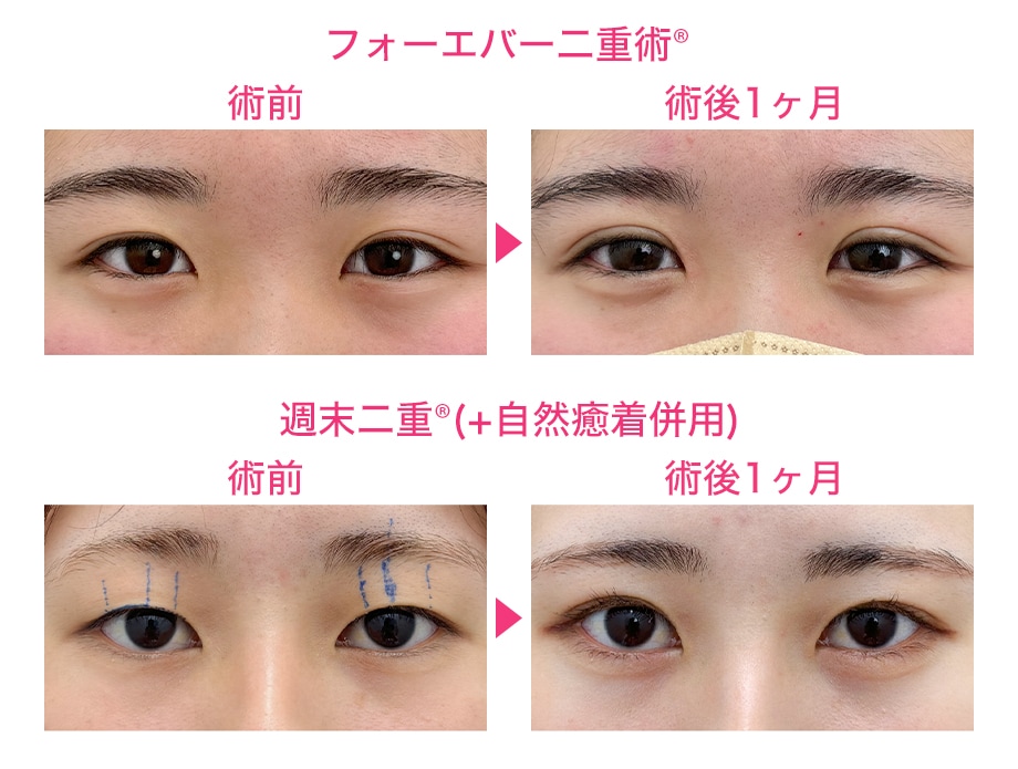 ピックアップ症例写真