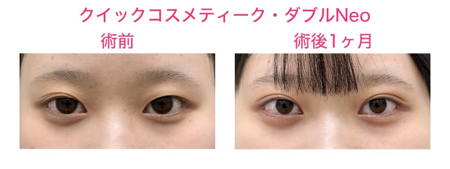 ピックアップ症例写真