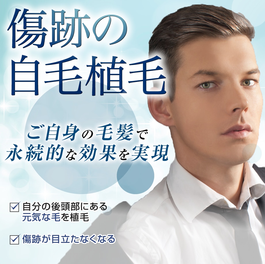 モニター募集
