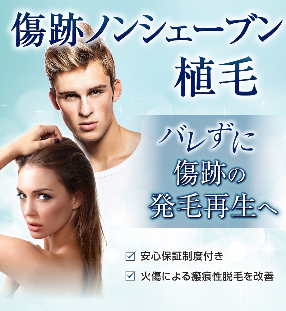 モニター募集