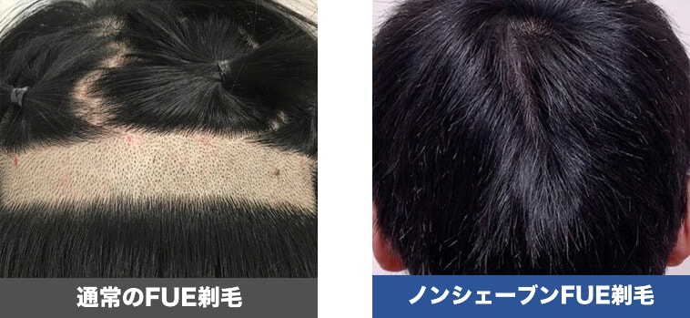 症例写真