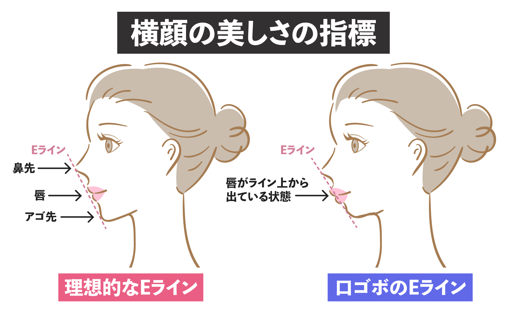 口 ゴボ 横顔