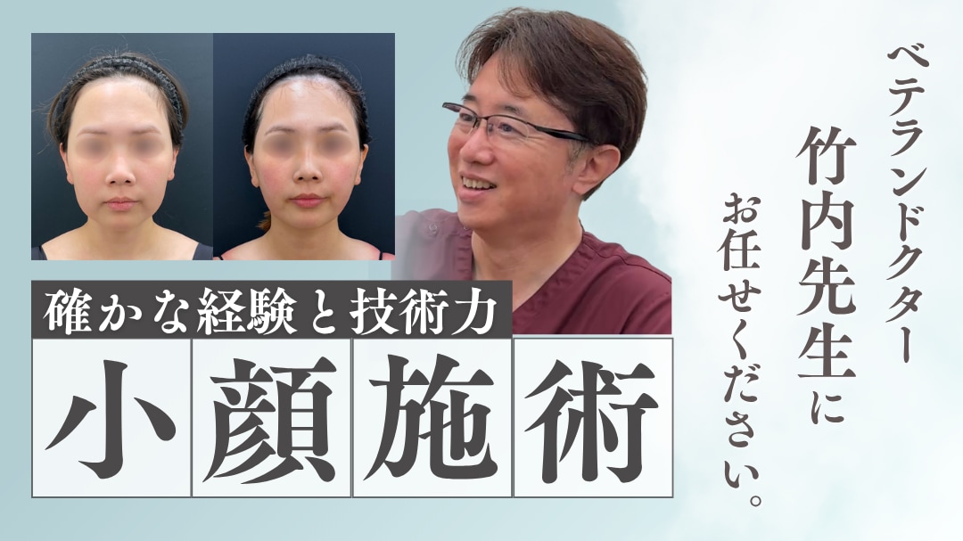 福岡で小顔なら竹内先生