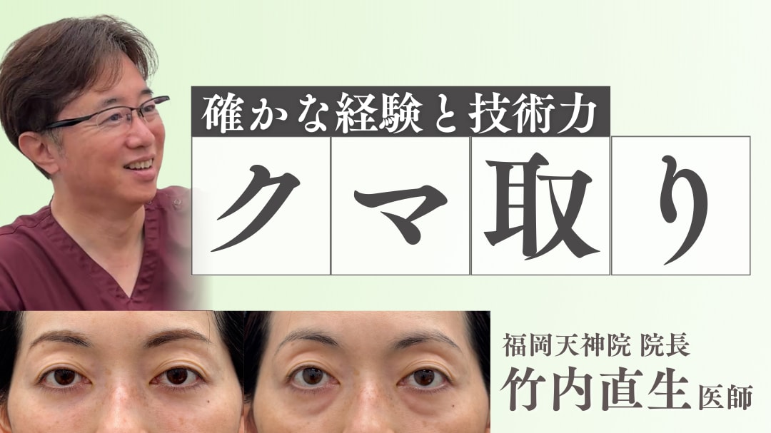 福岡天神院クマ取り