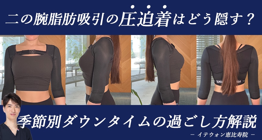 二の腕脂肪吸引後の圧迫着はどう隠す？季節別ダウンタイムの過ごし方解説