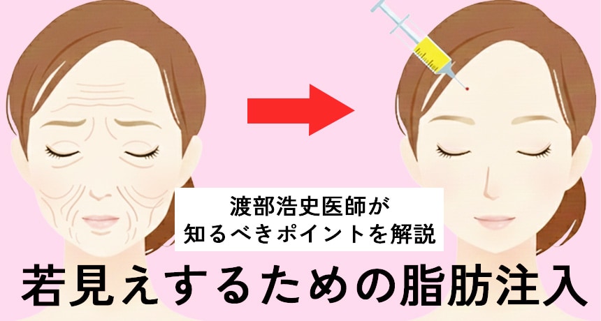 若見えするための脂肪注入、知っておくべきポイントを渡部浩史医師が解説