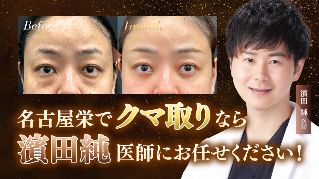 名古屋栄でクマ取りなら濱田純医師にお任せください！