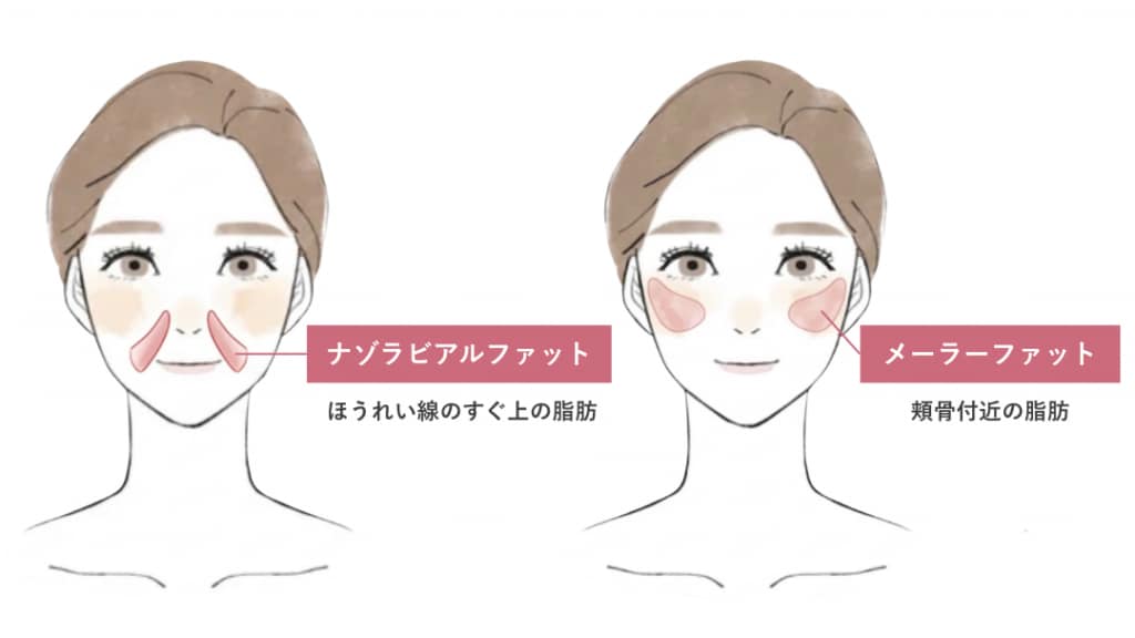 ナゾラビアルファット・メーラーファット図