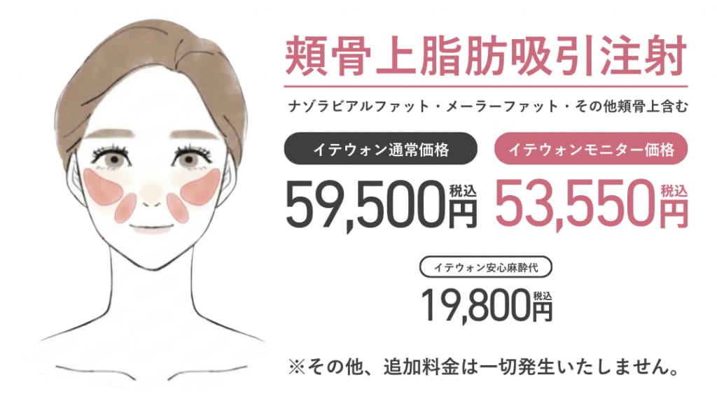 頬骨上脂肪吸引注射価格