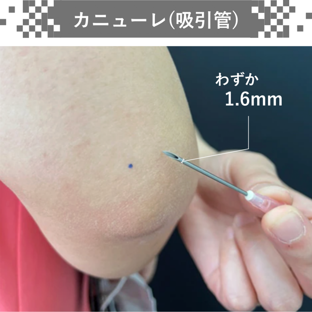 カニューレ画像