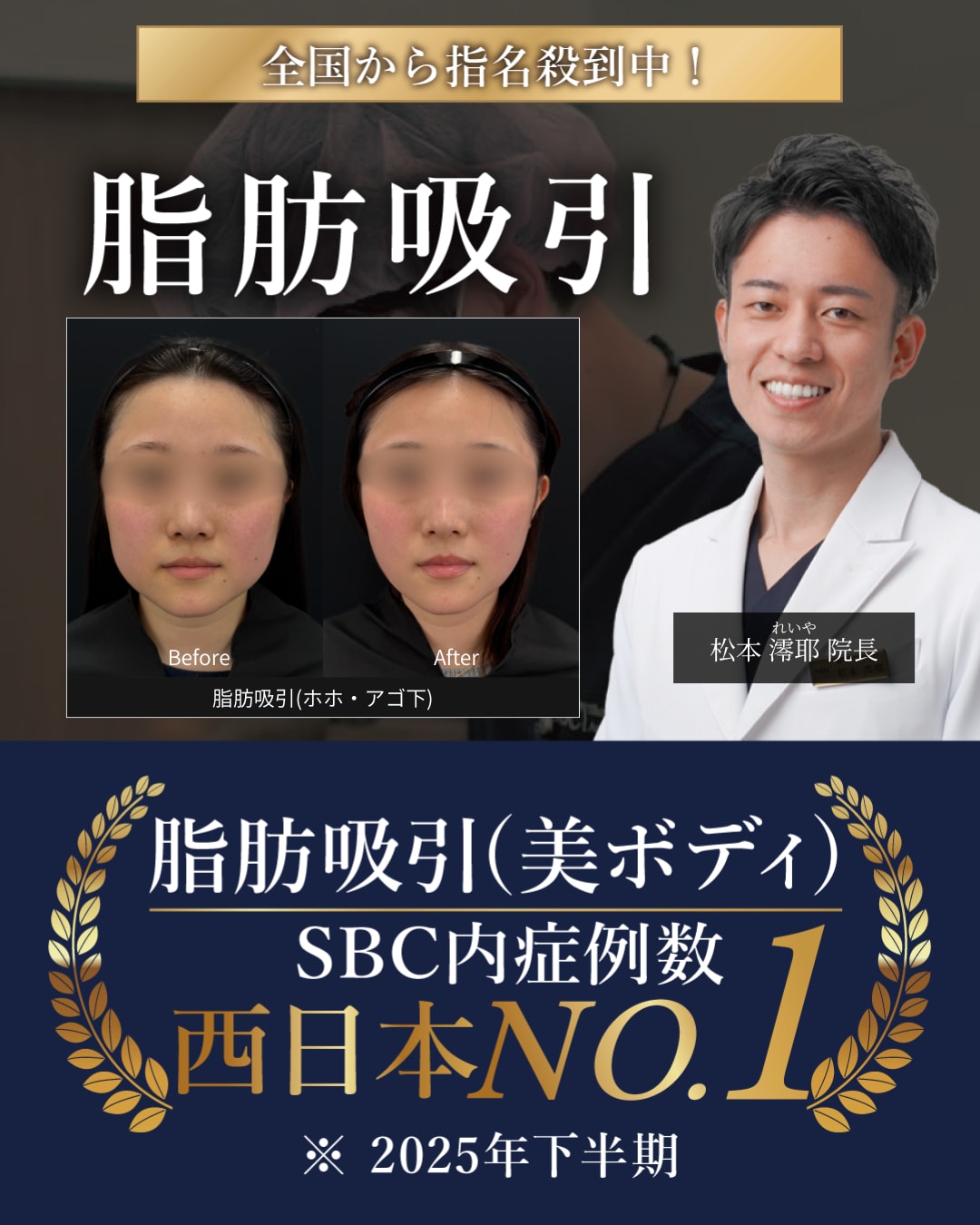 イテウォン神戸院 松本れいや院長による顔の脂肪吸引