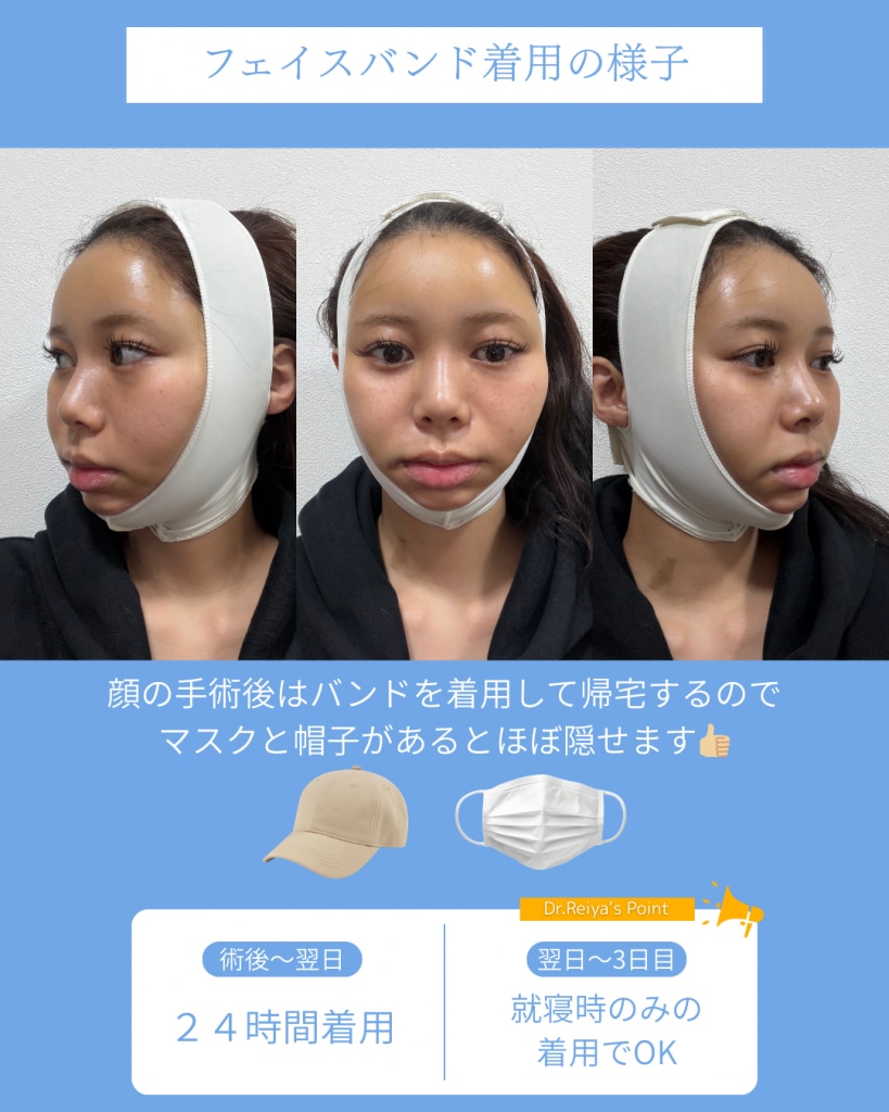 脂肪吸引のフェイスバンド
