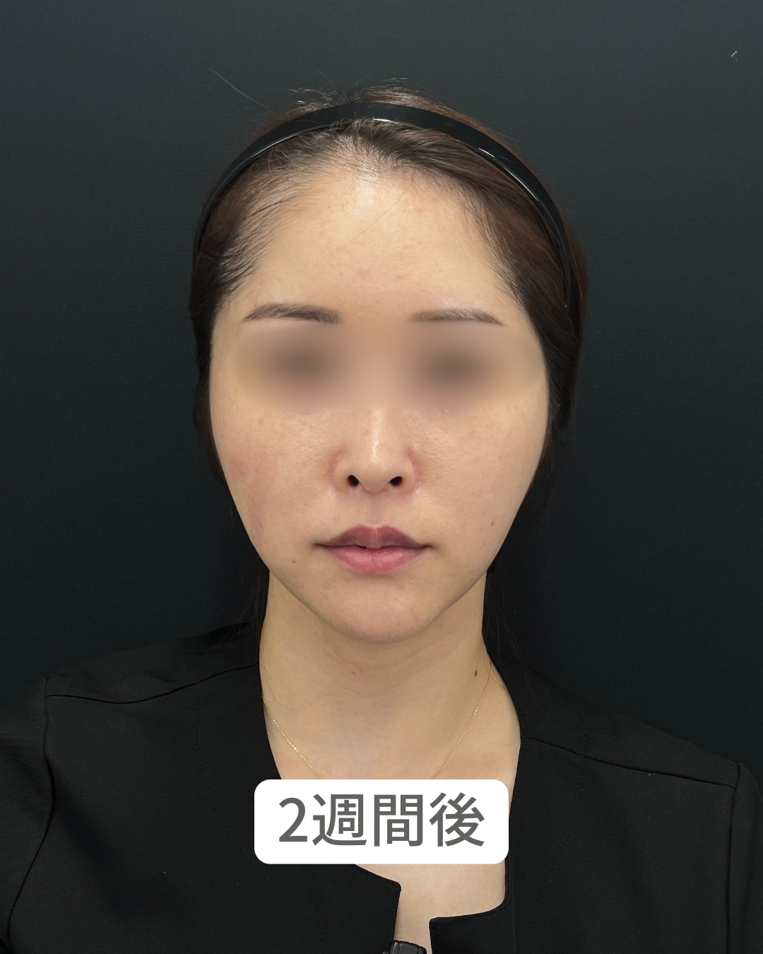 2週間後