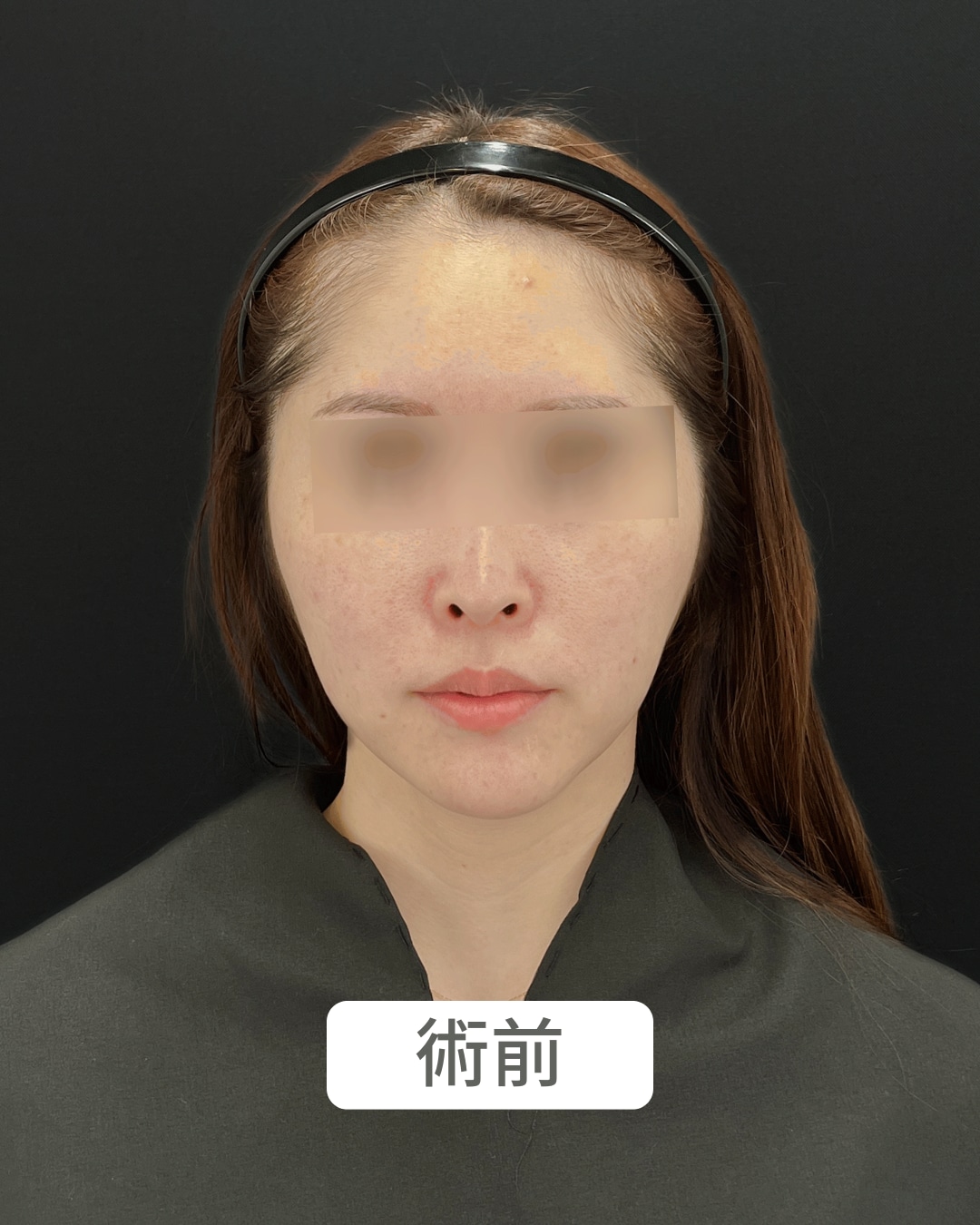 術前