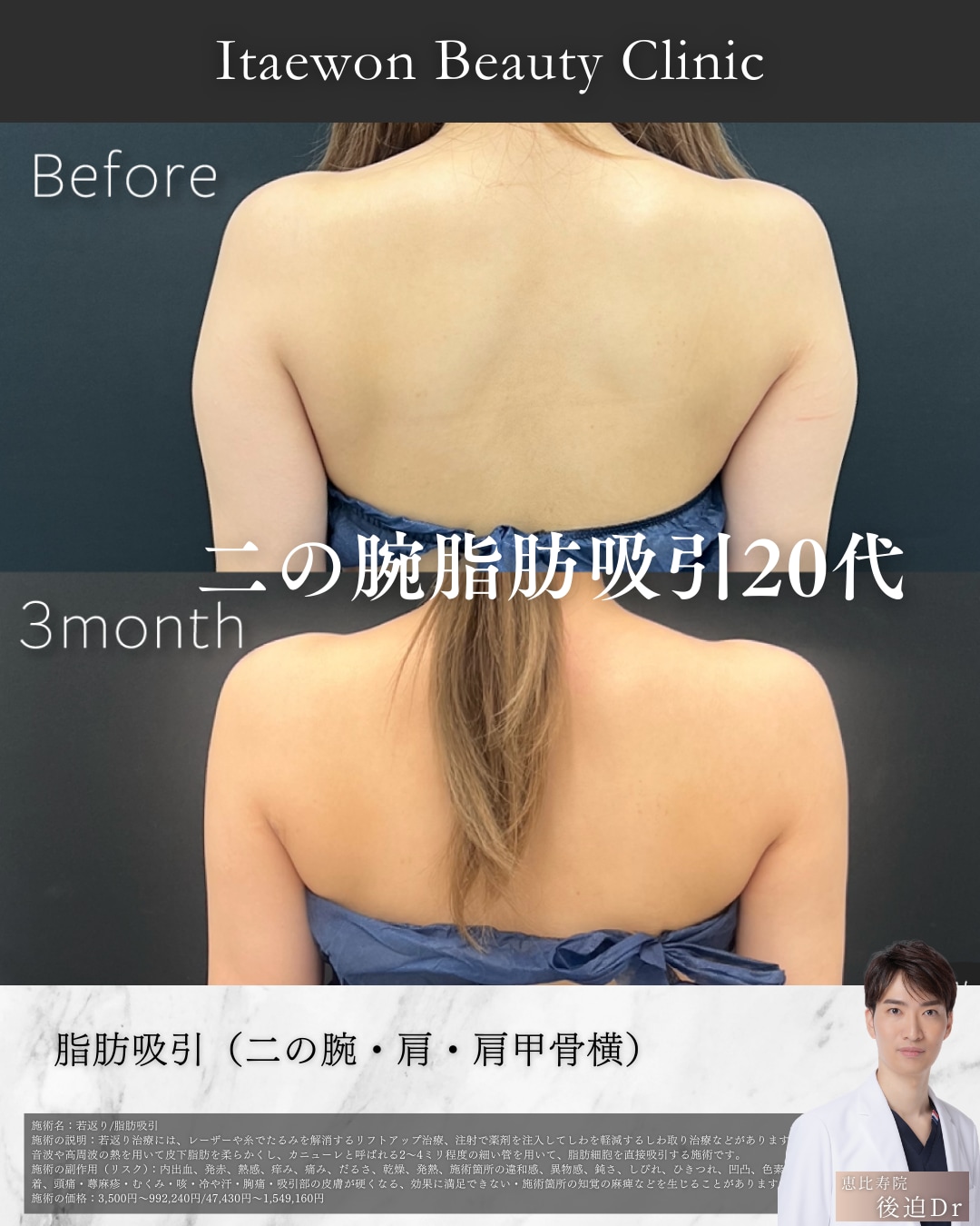 二の腕1