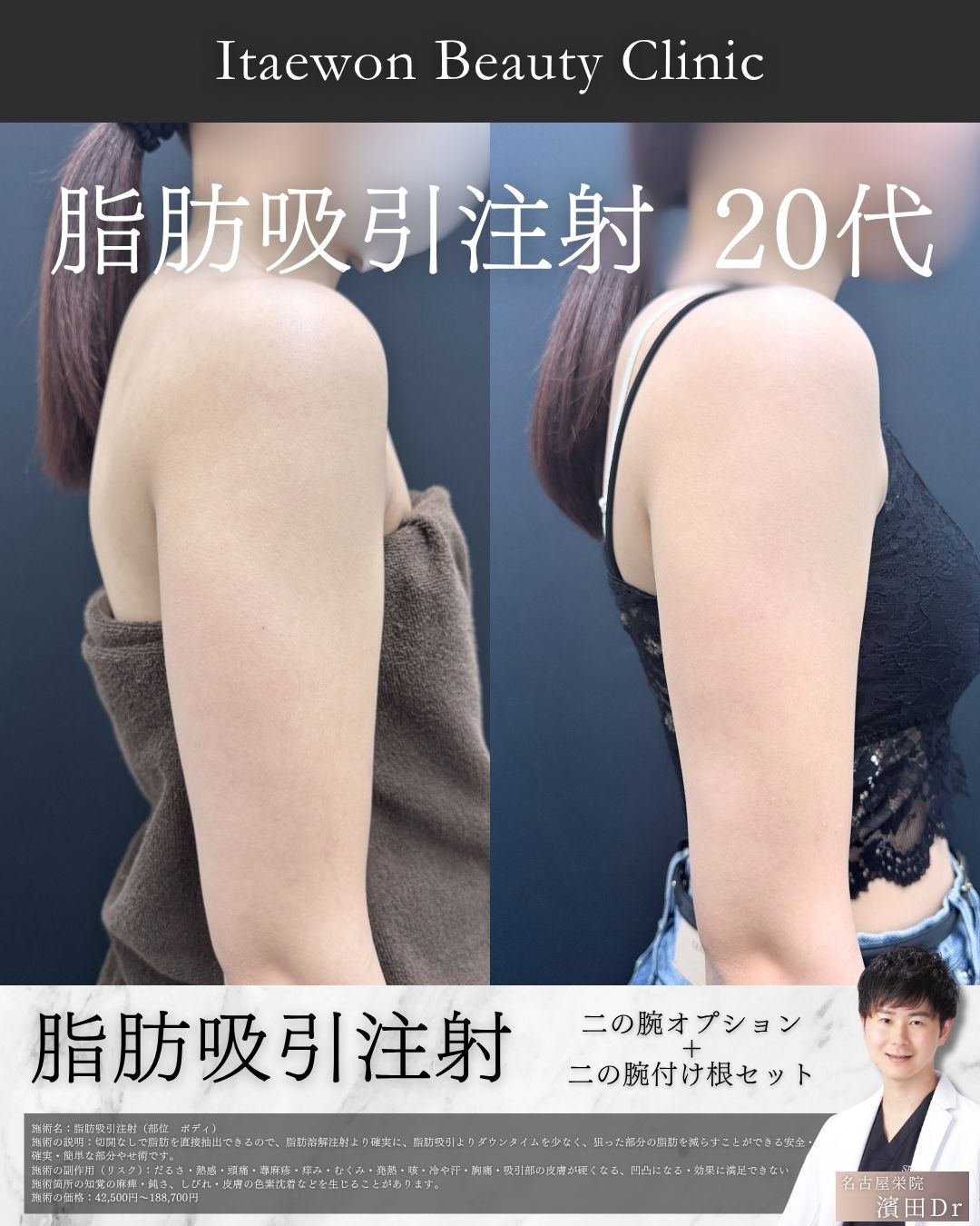 二の腕3