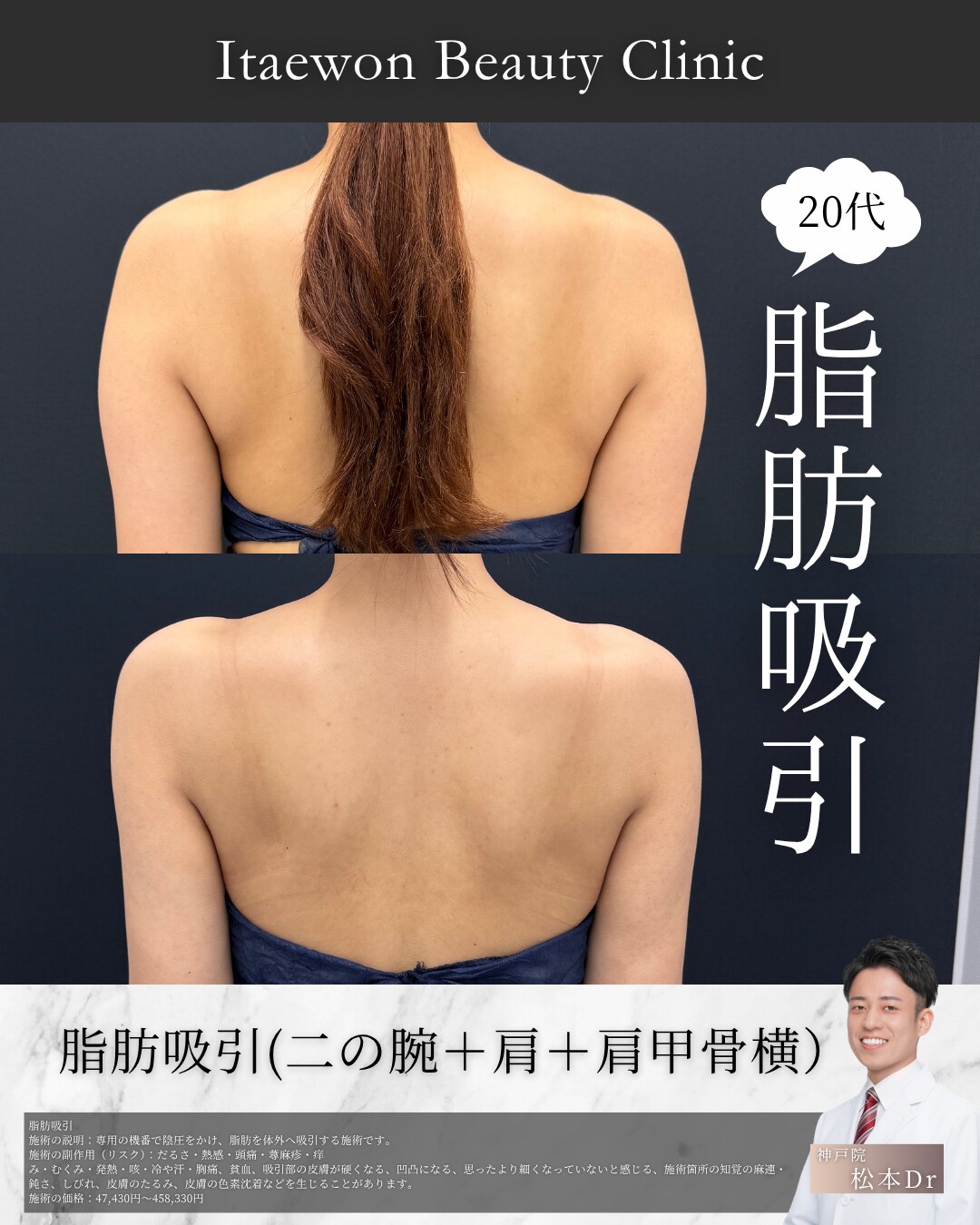 二の腕5