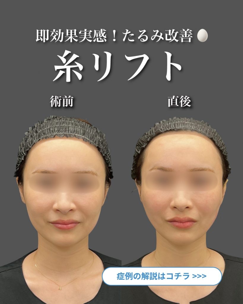 1枚目