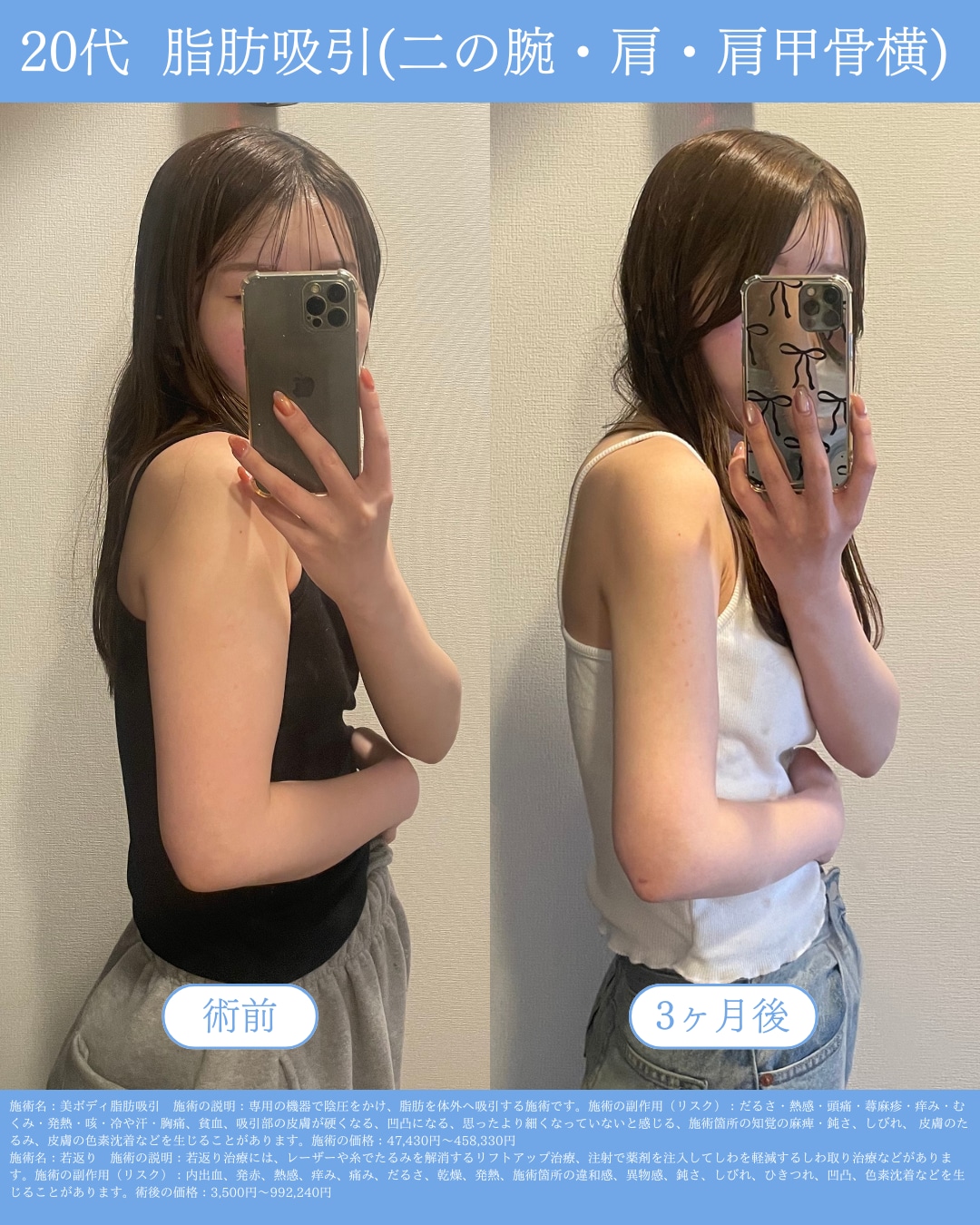 3ヶ月Before→After