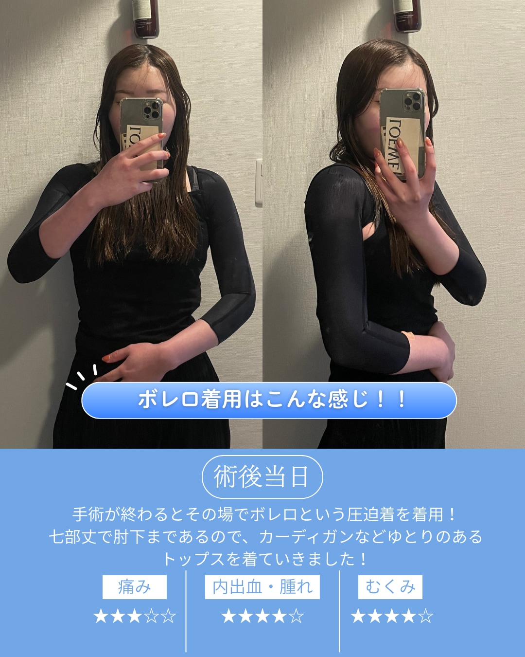 手術当日