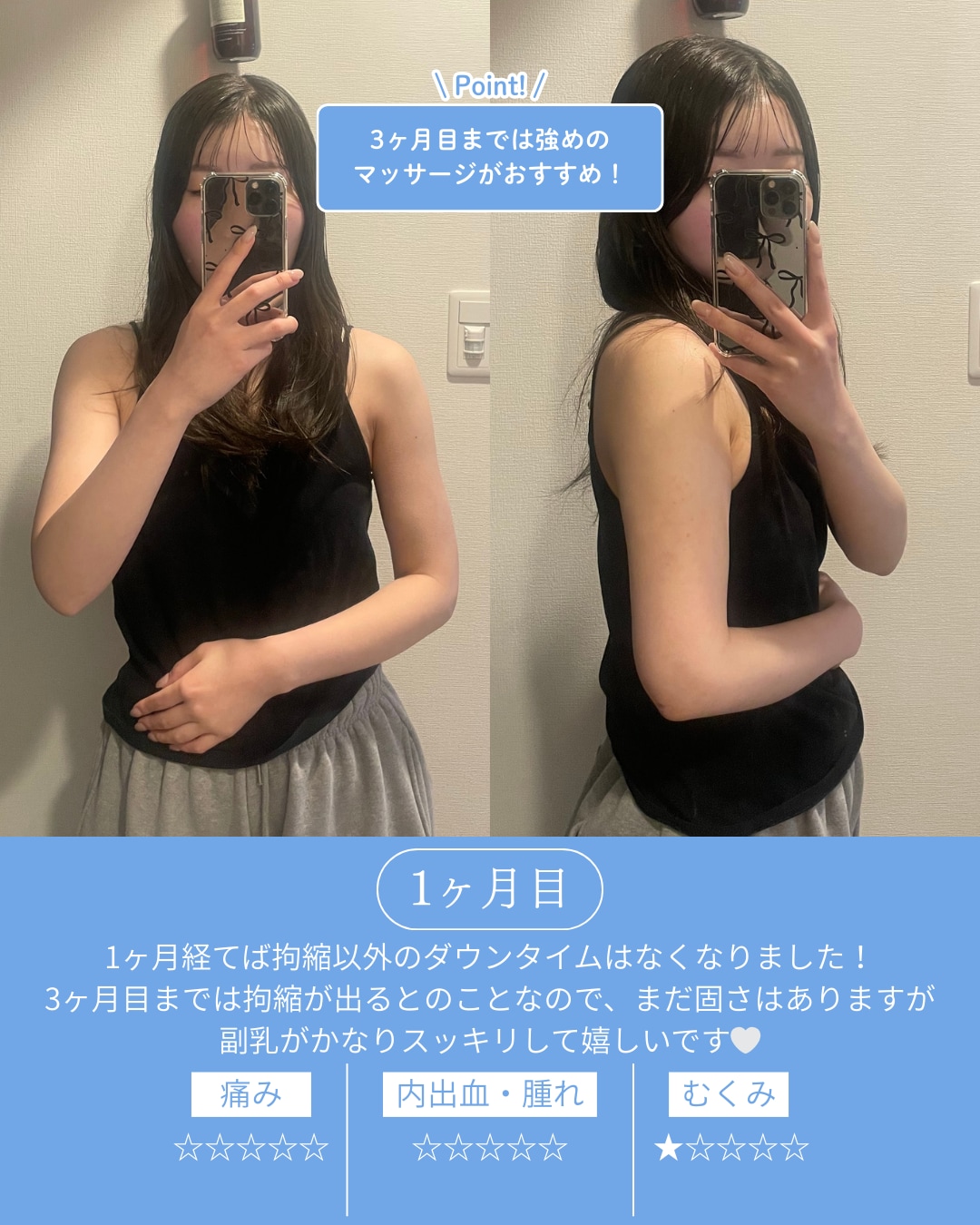 術後1ヶ月